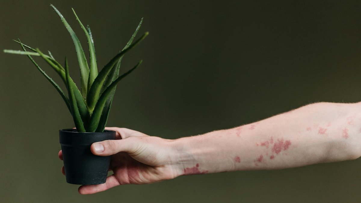 plant sunburn