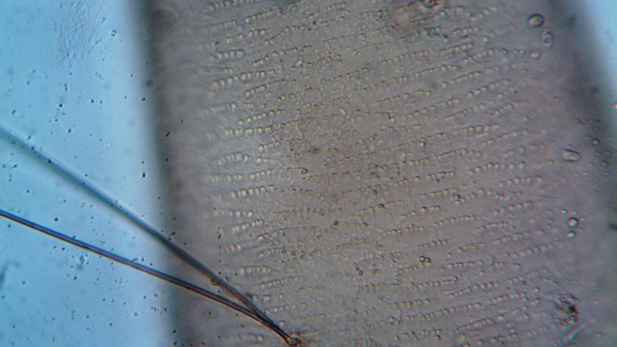 nematodes microscopic