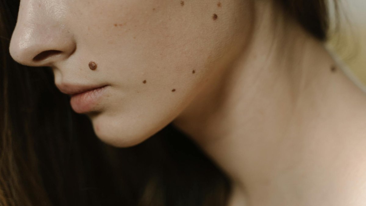 castor oil mole